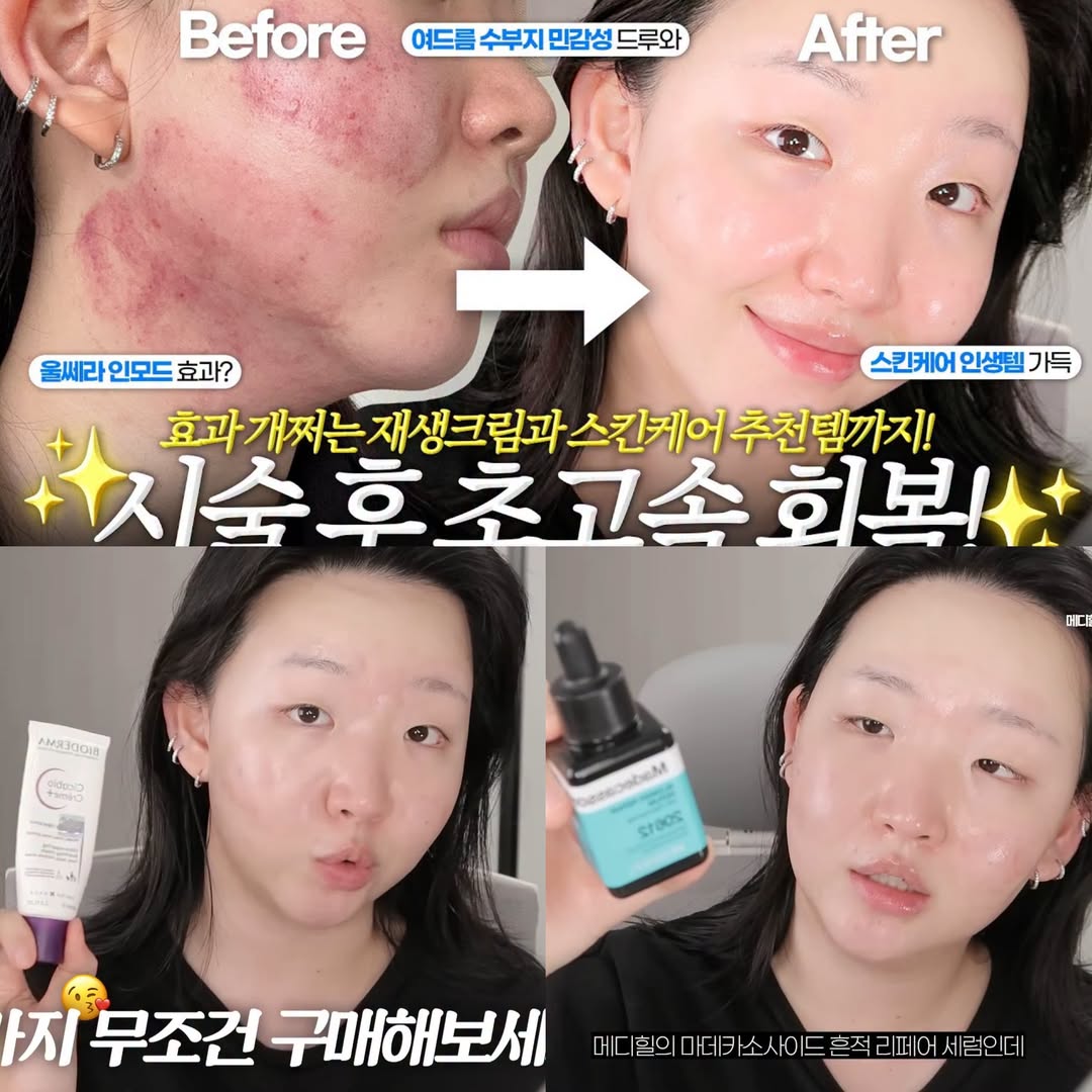 YouTuber Toxin chia sẻ quy trình phục hồi da mụn với các sản phẩm dễ mua 1 719026908 28165729599682157 7308899427919391653 n